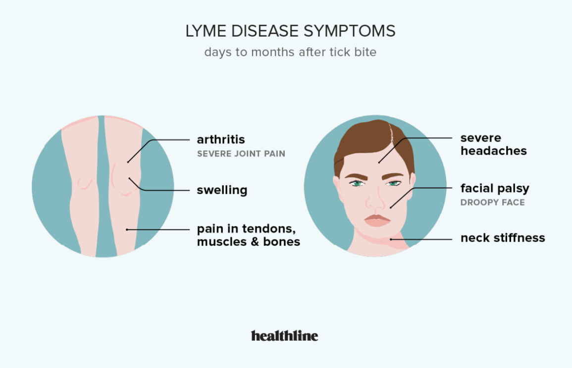lyme disease symptoms that happen months later